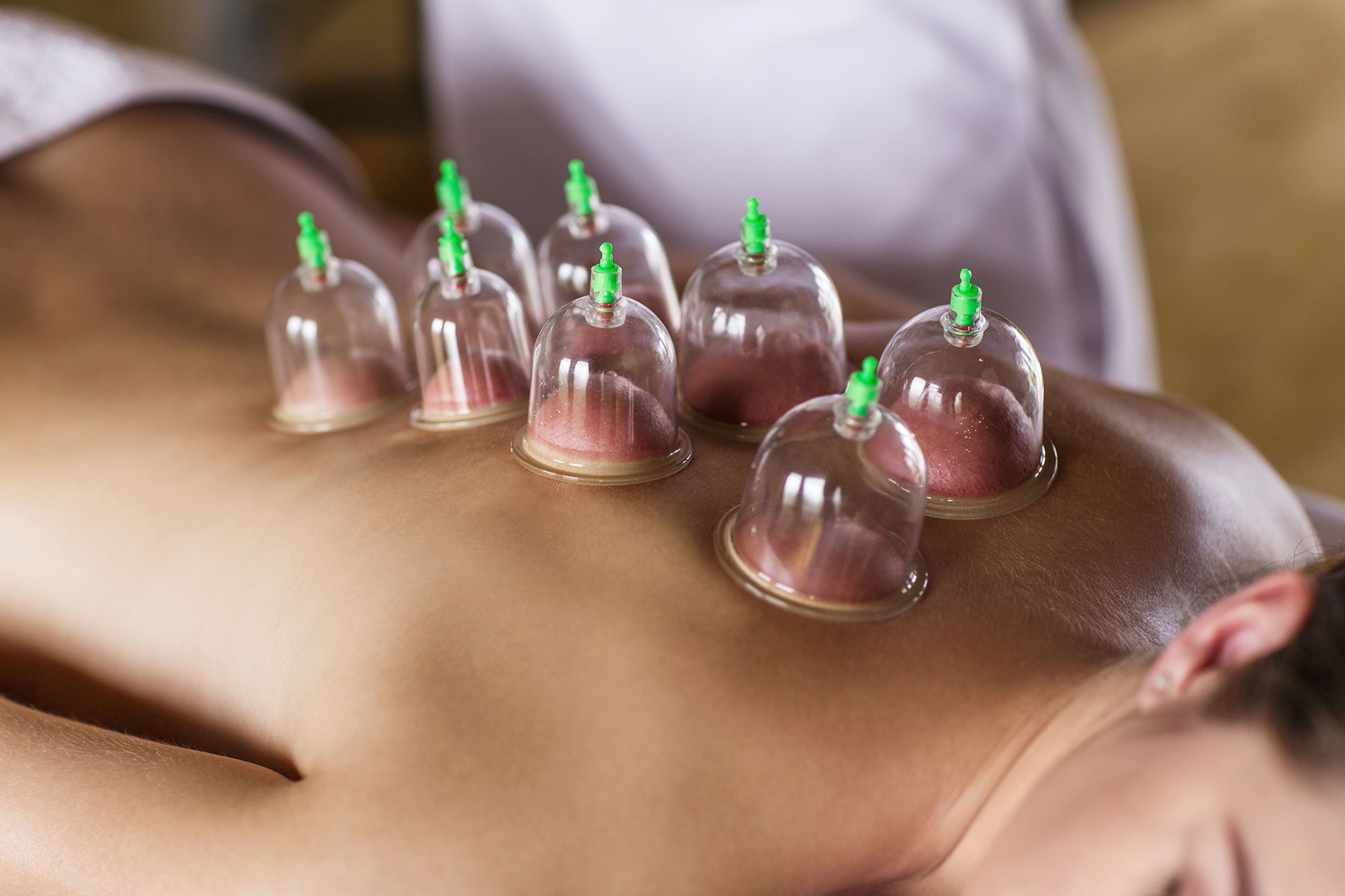 Massage Cupping sessions available at Sound Mind & Body - Natick, MA